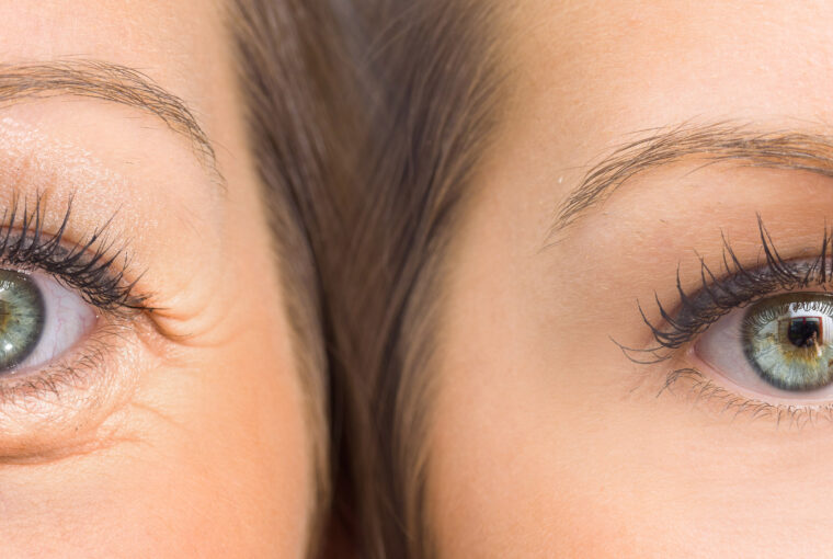 Zaffiro, czyli skuteczna metoda anti-aging